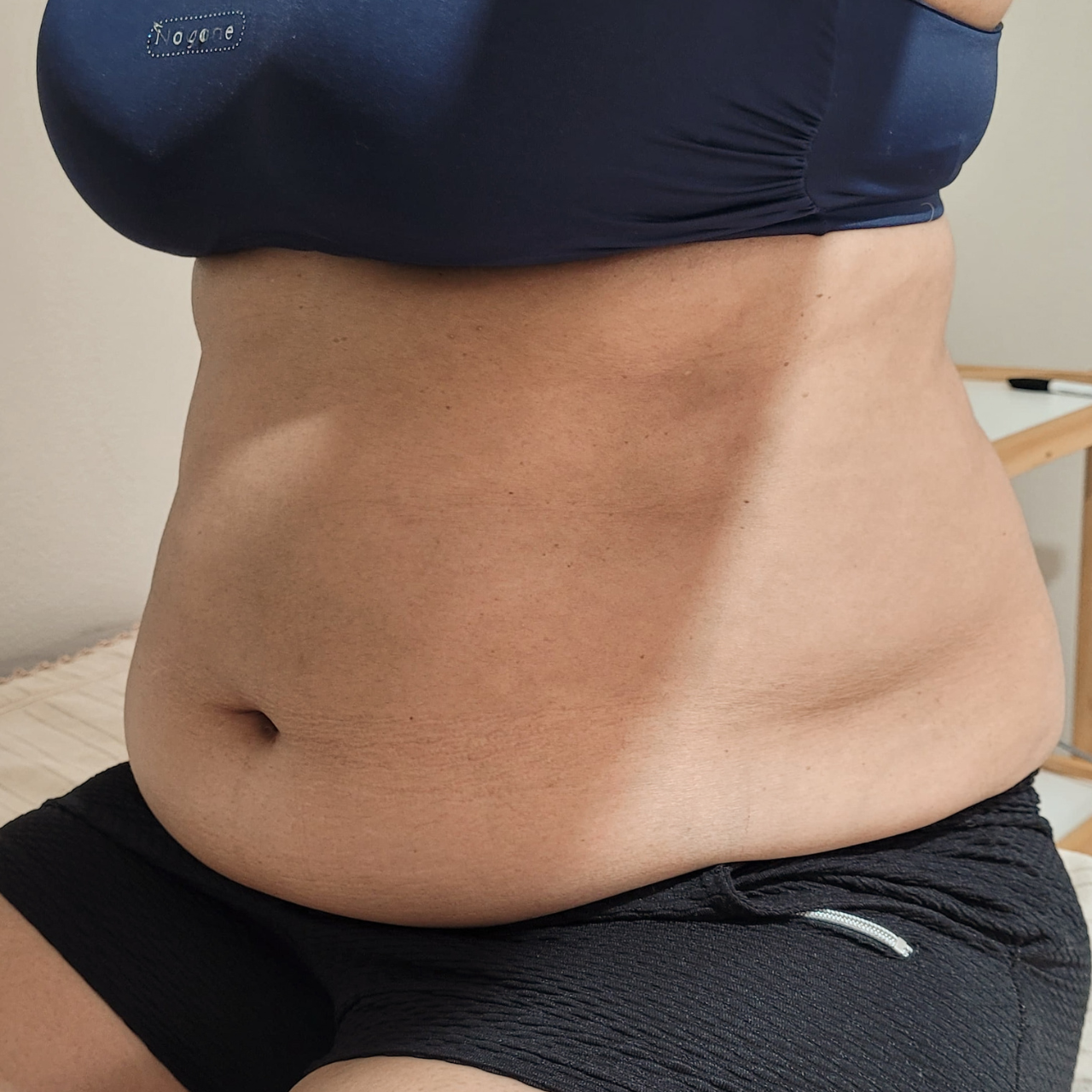 Antes - Body Sculpt - Abdômen