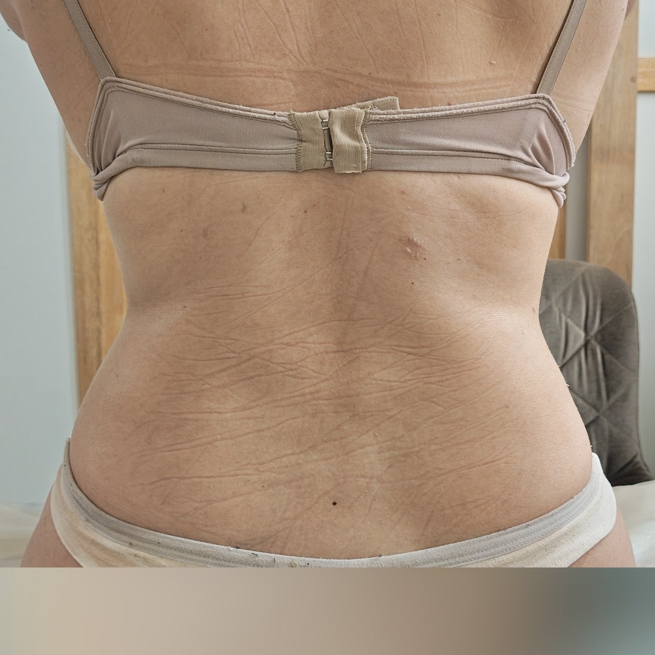 Depois - Body Sculpt - Flancos e Costas